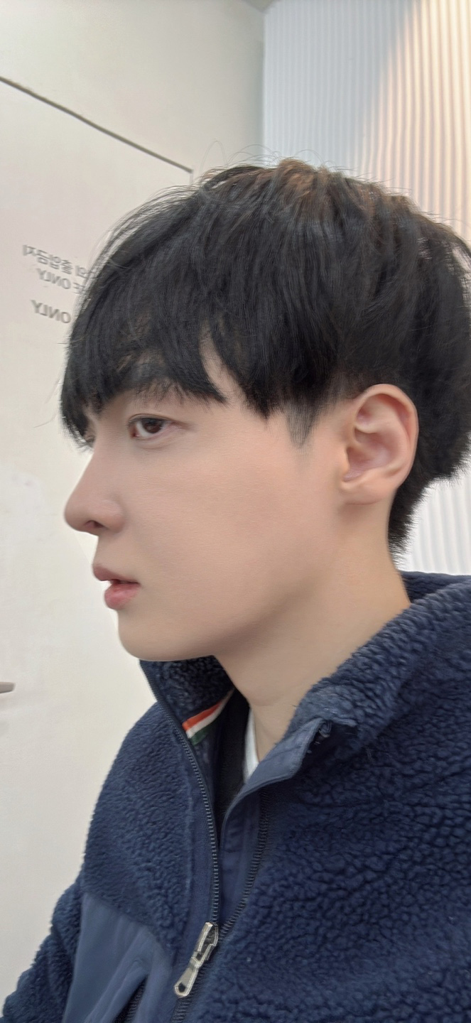 수술후기이미지