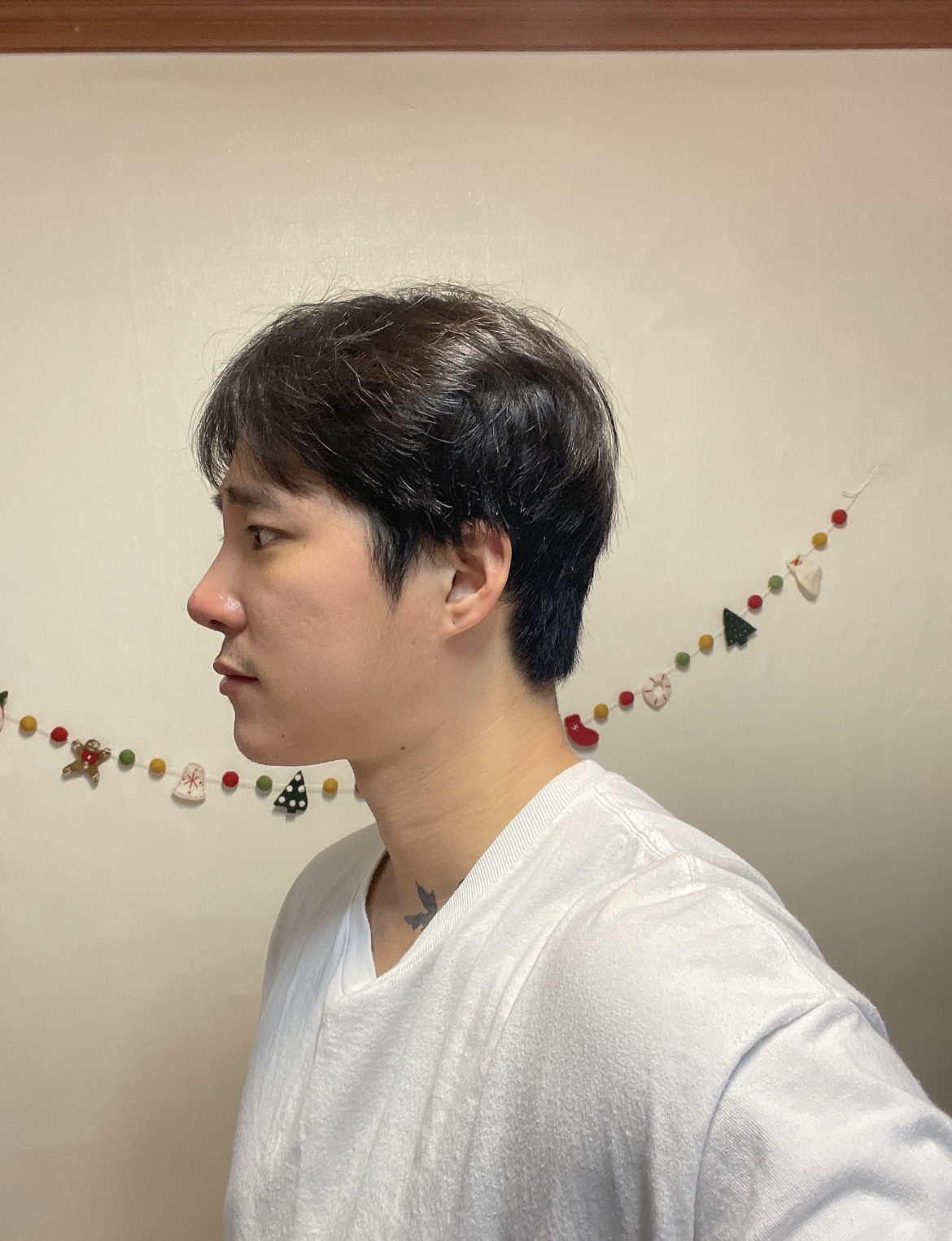 수술후기이미지