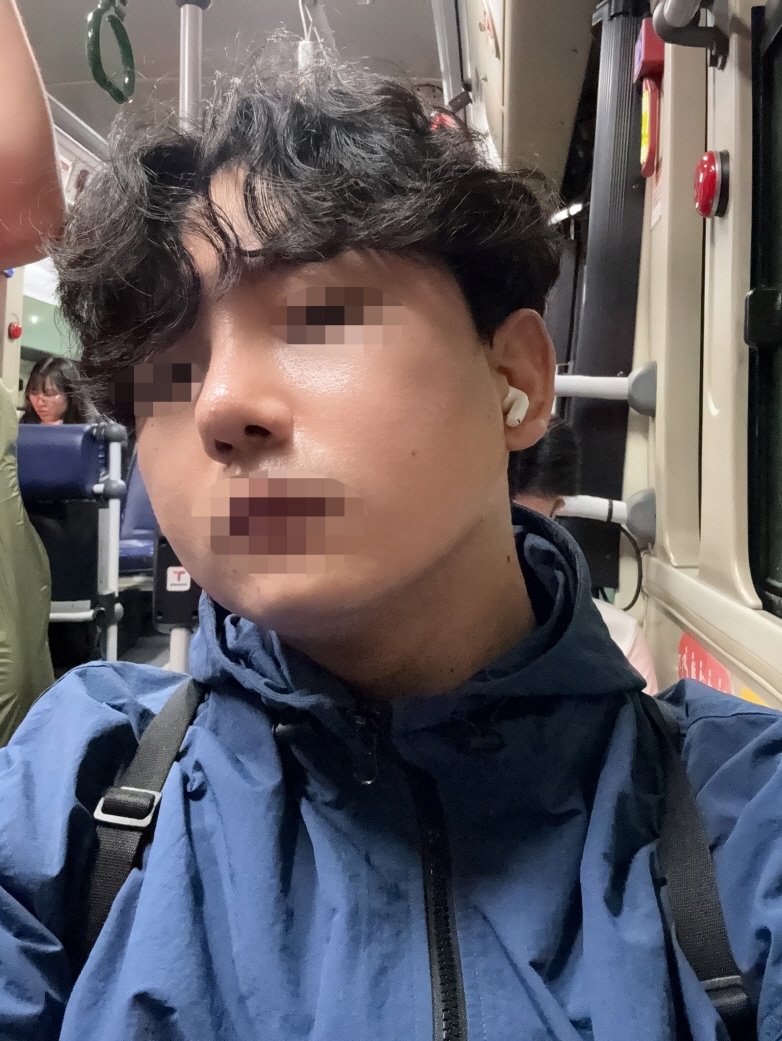 수술후기이미지