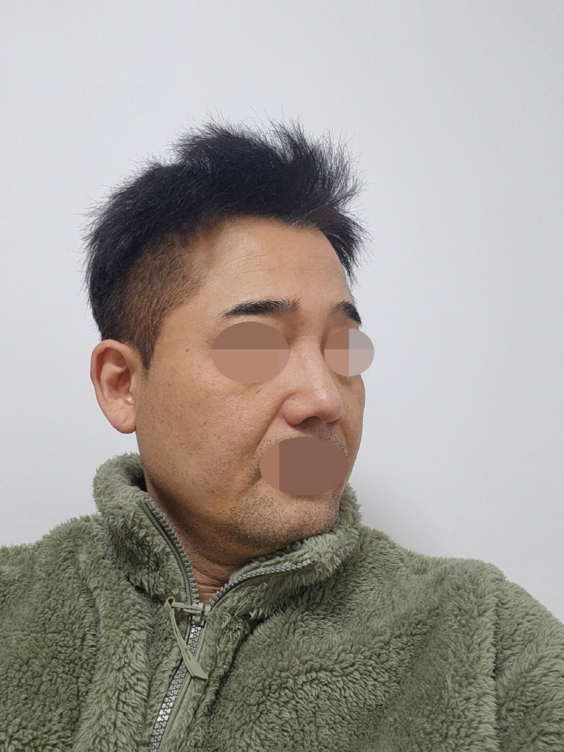 수술후기이미지