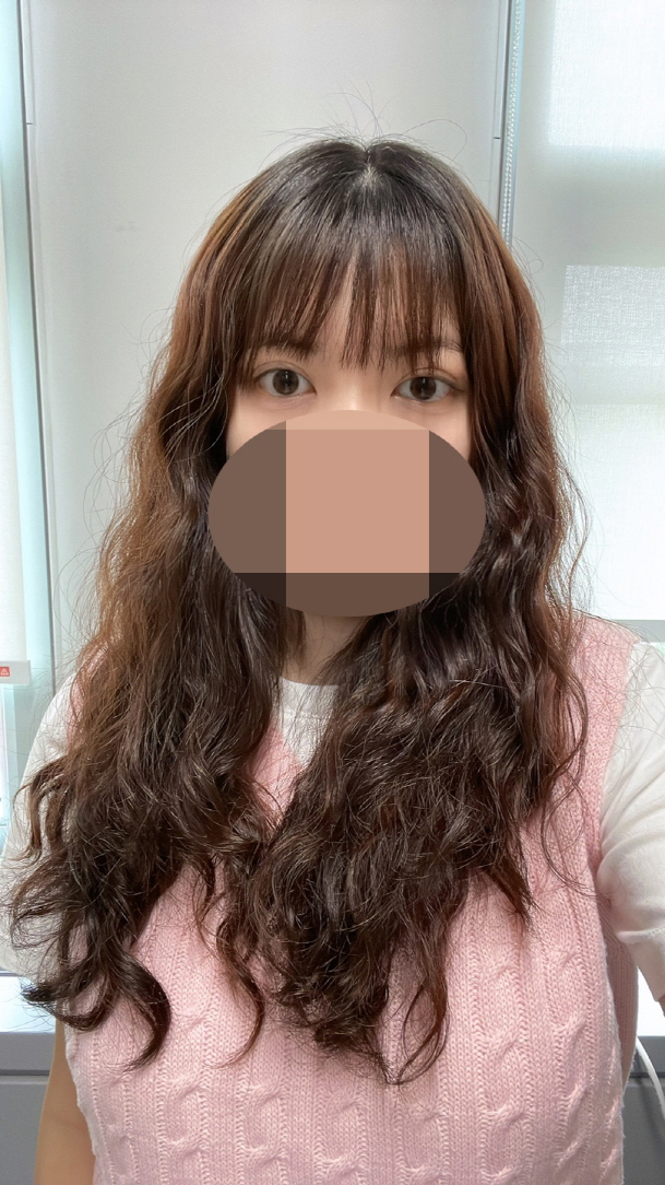 수술후기이미지