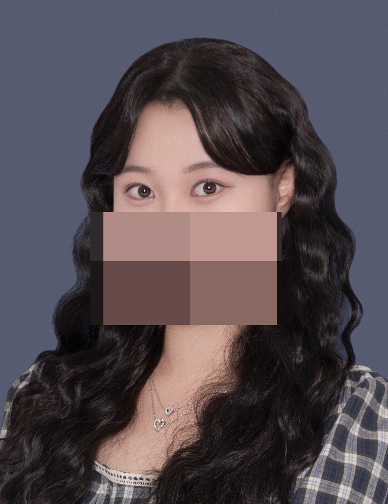 수술후기이미지