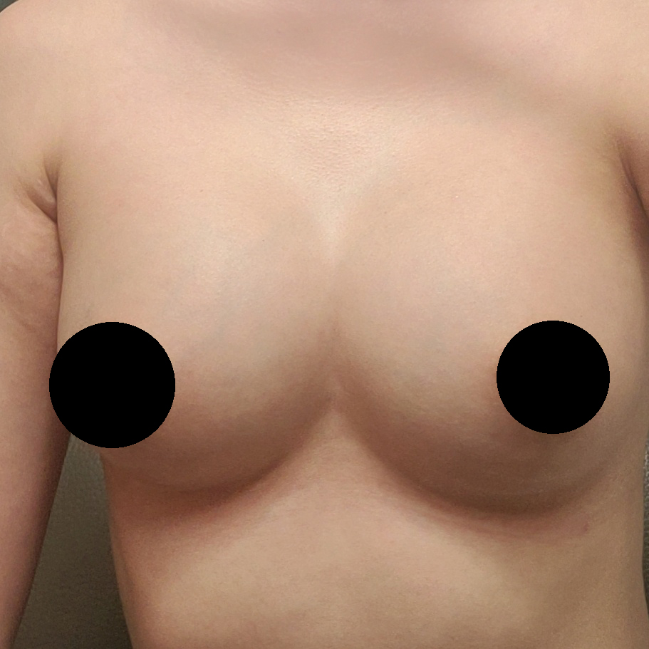 수술후기이미지