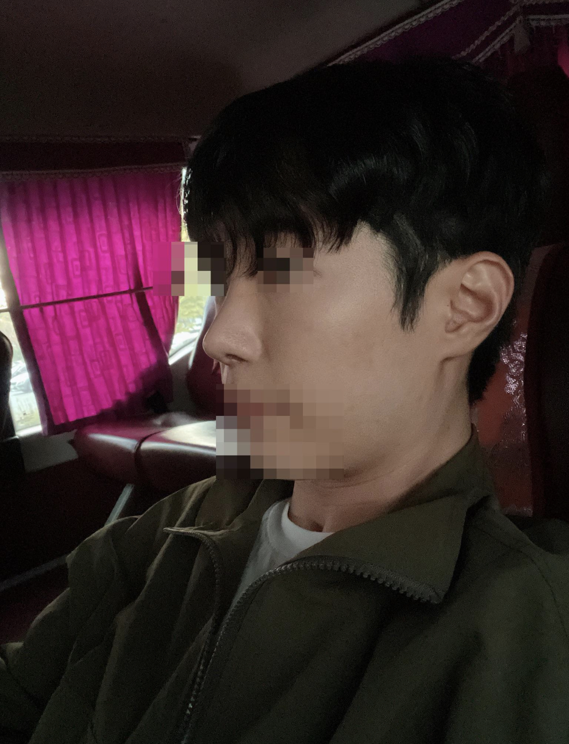 수술후기이미지