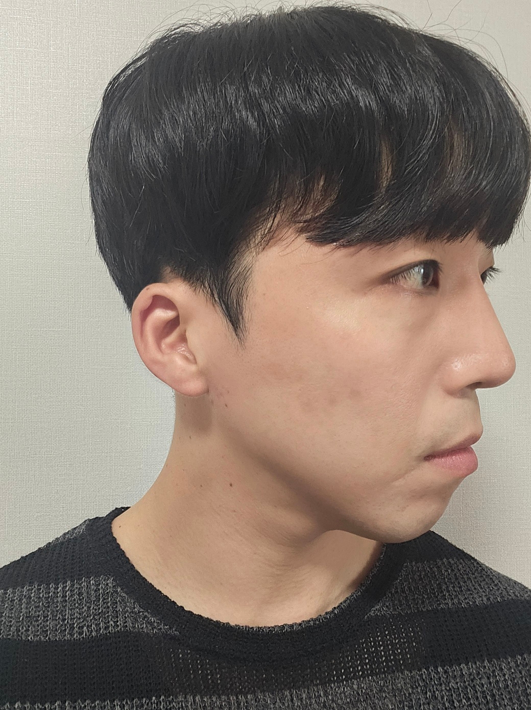 수술후기이미지