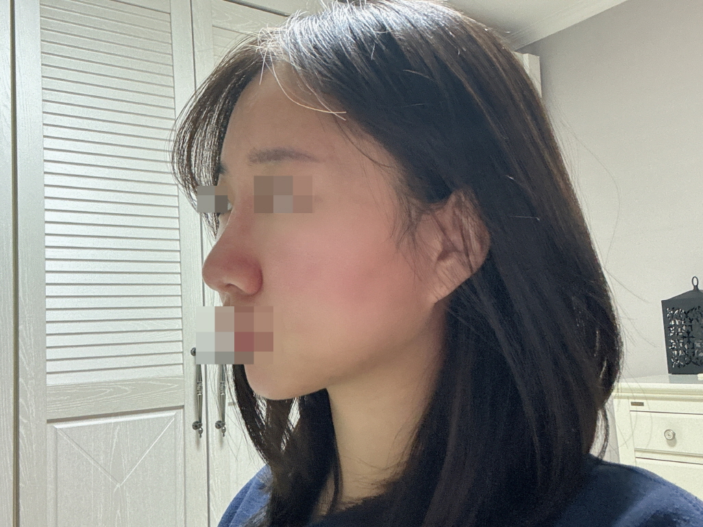 수술후기이미지