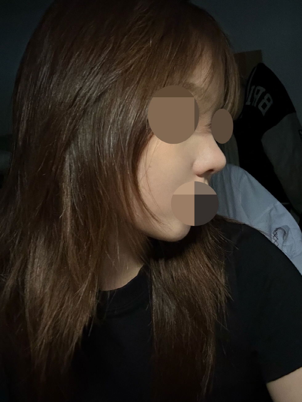 수술후기이미지