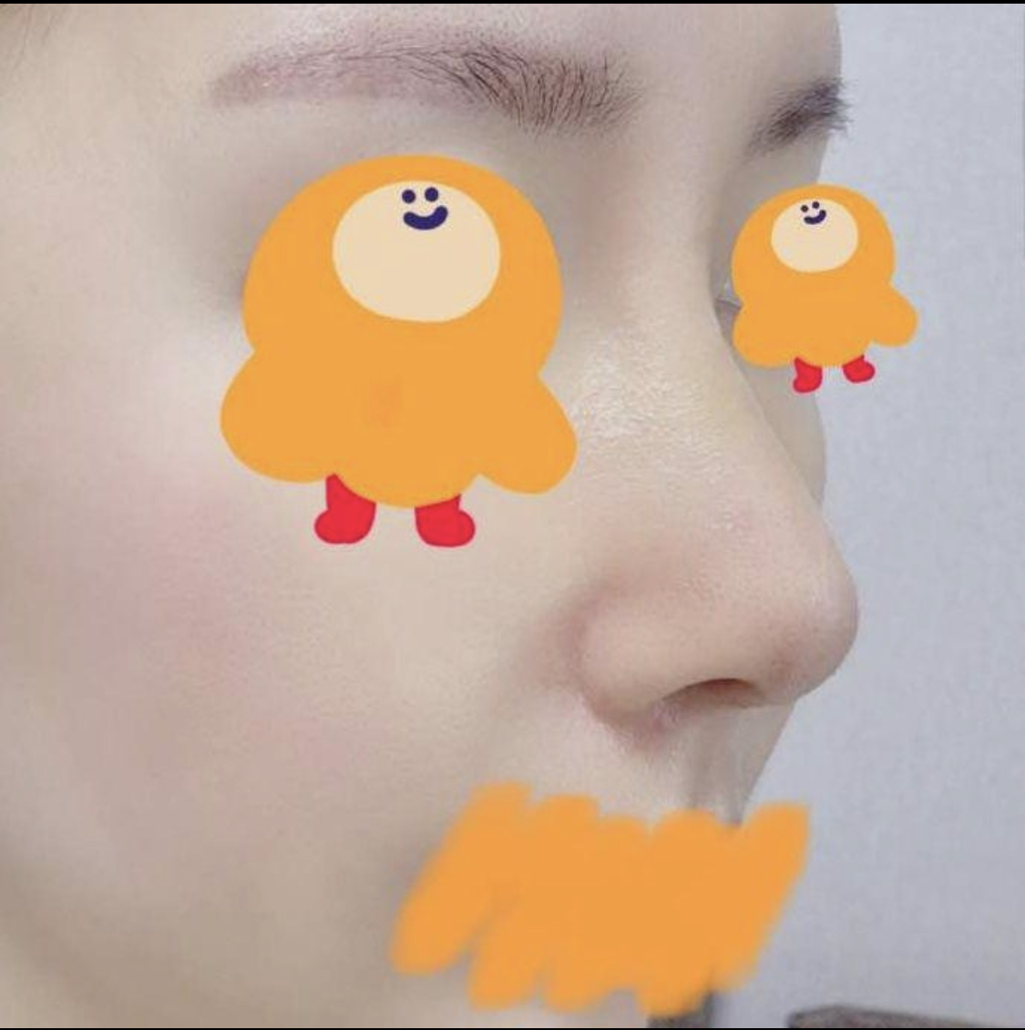 수술후기이미지