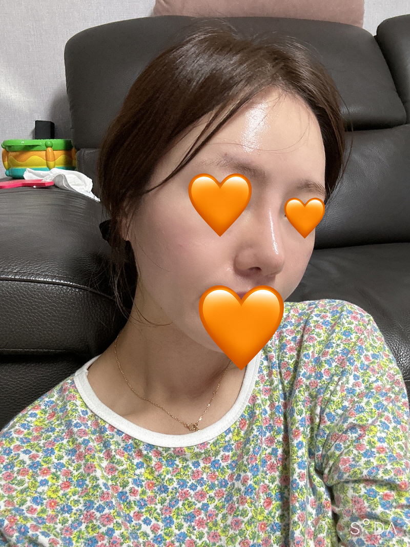 수술후기이미지