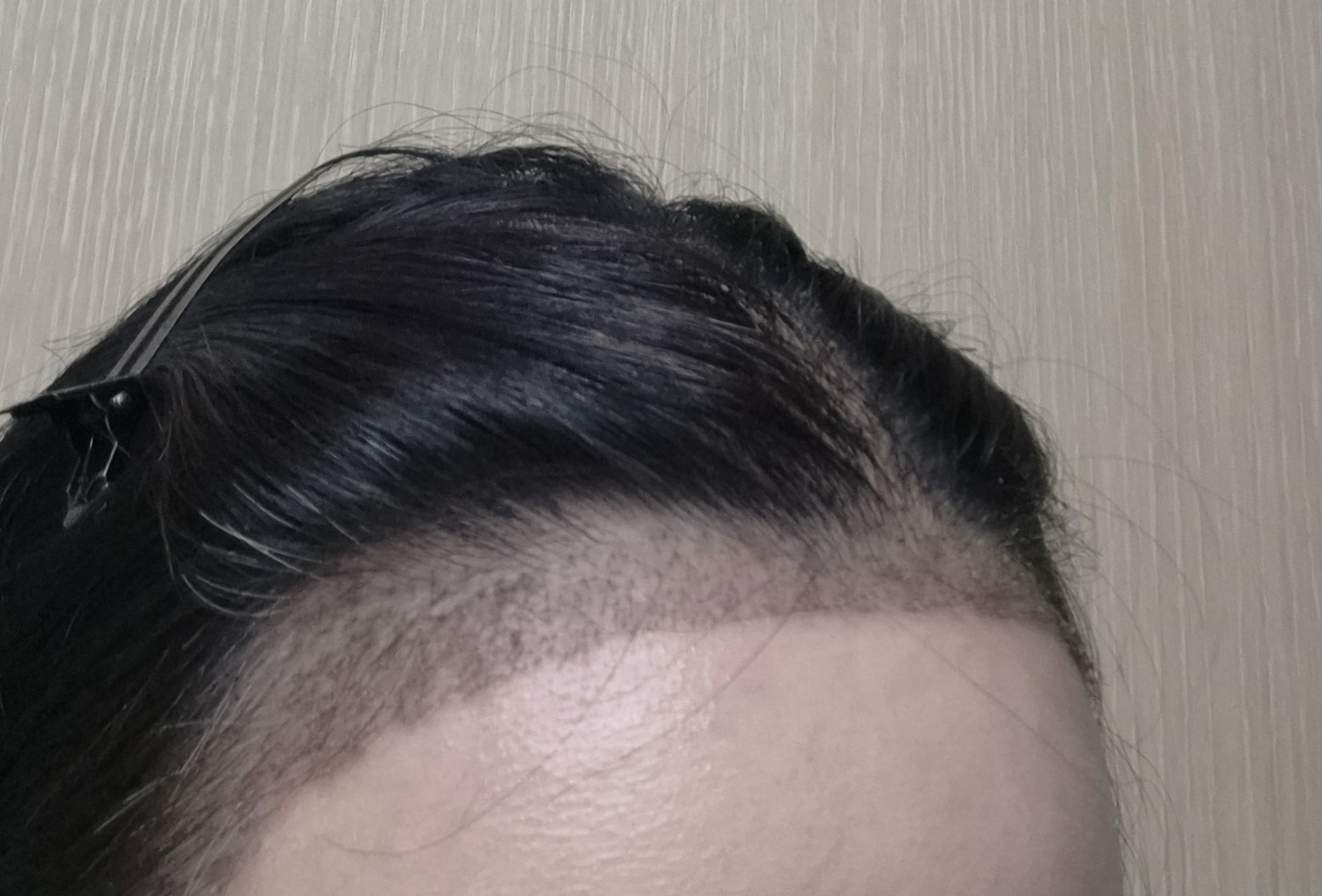수술후기이미지