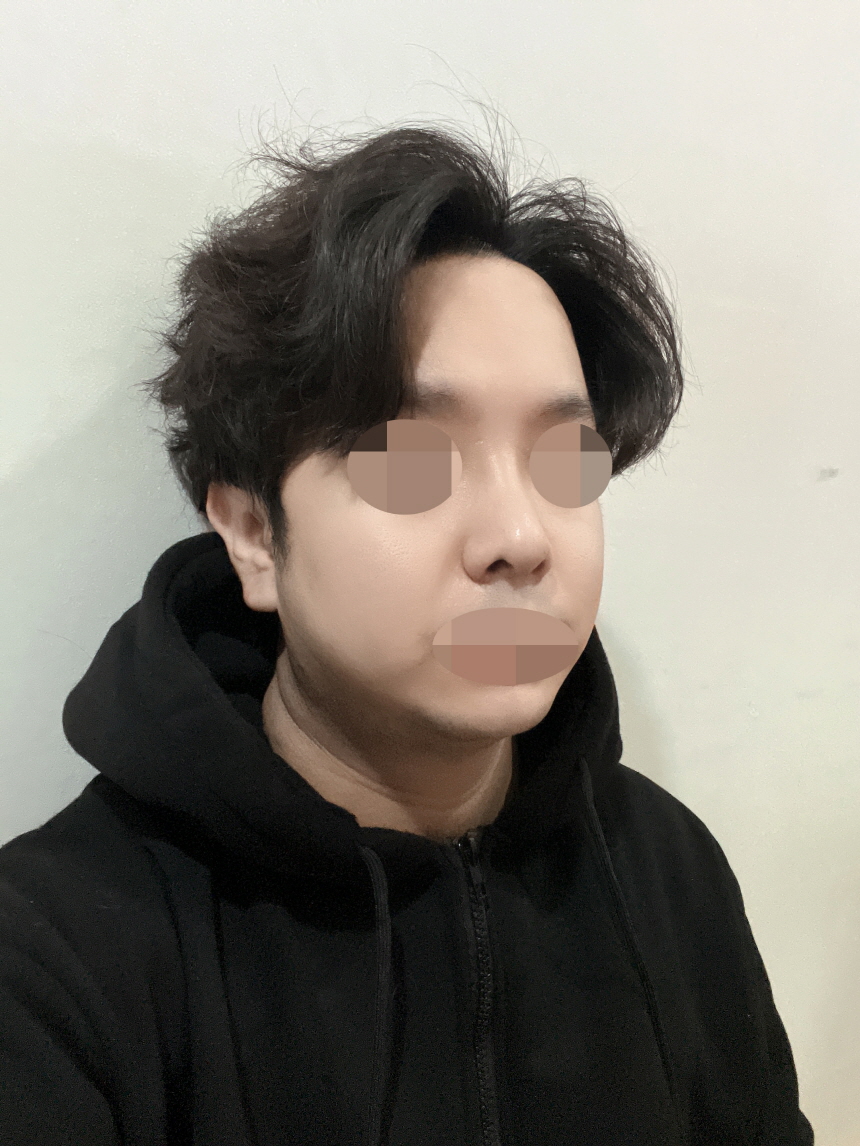 수술후기이미지