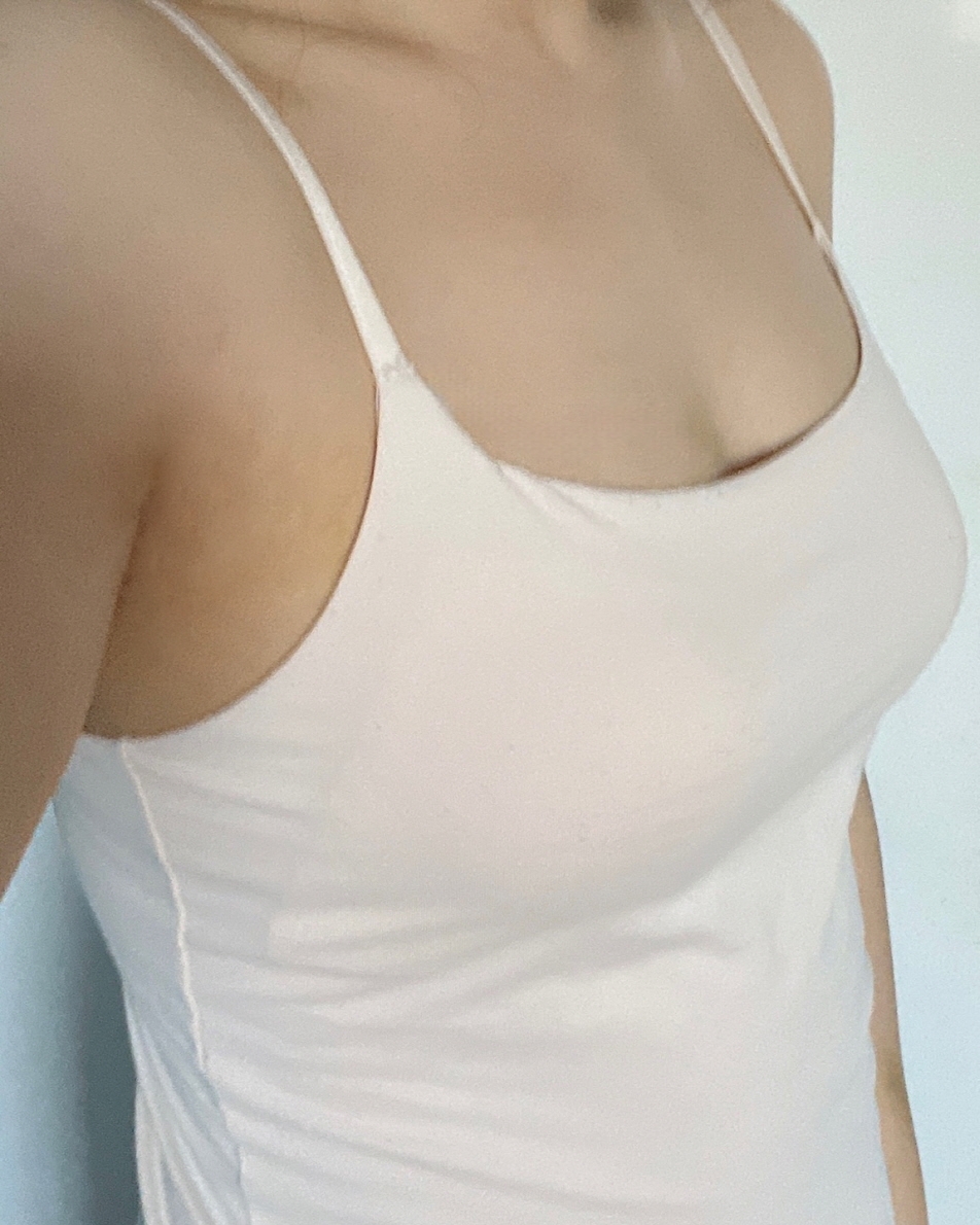 수술후기이미지