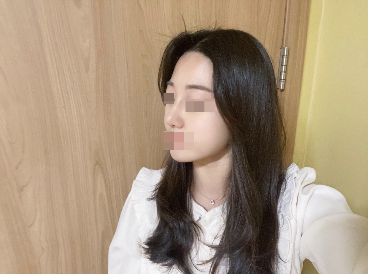 수술후기이미지