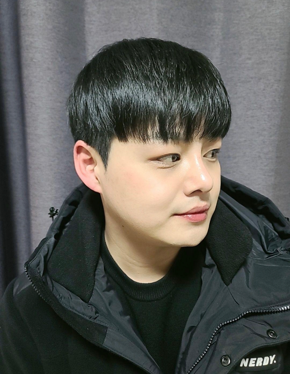 수술후기이미지