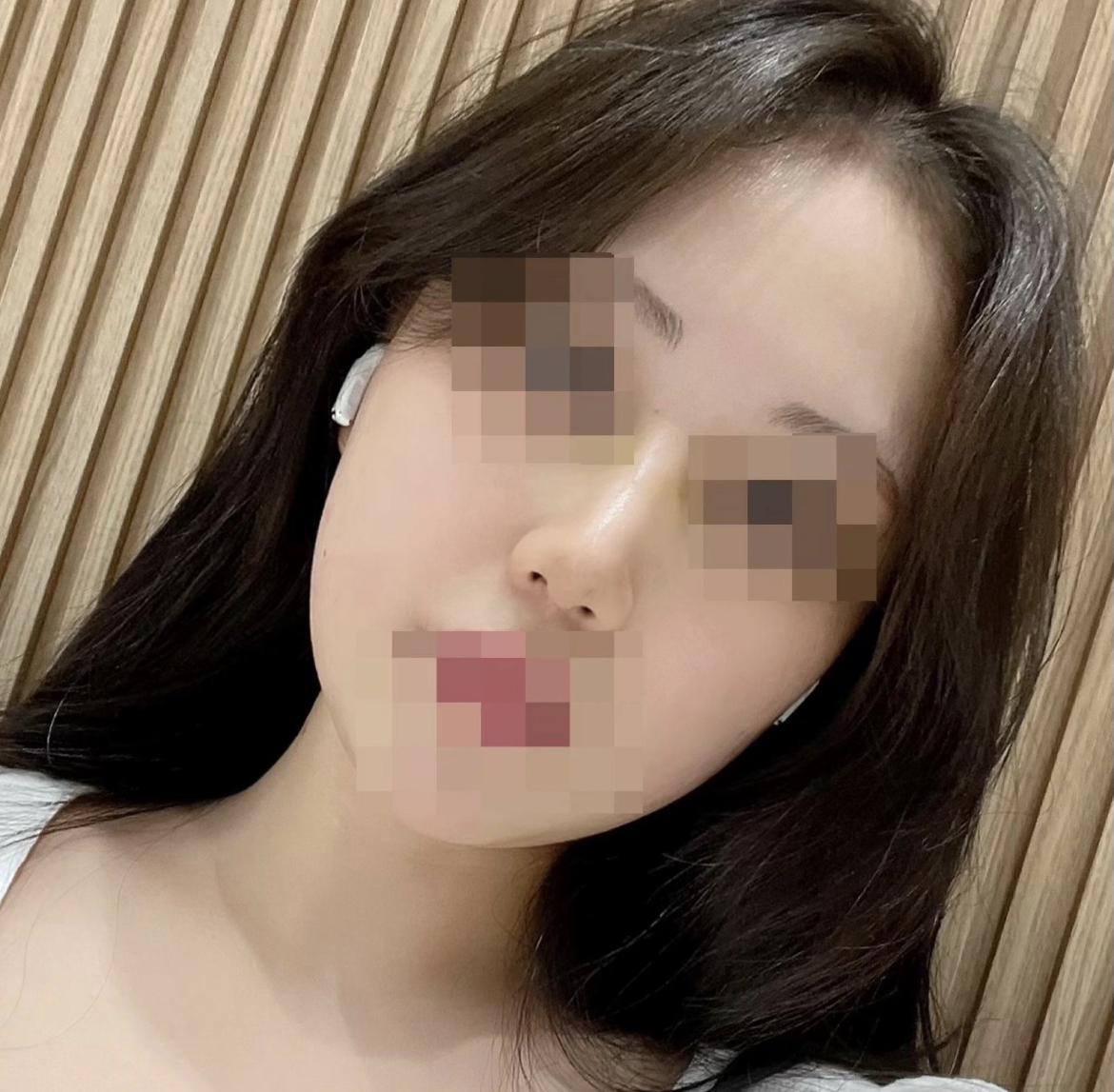 수술후기이미지