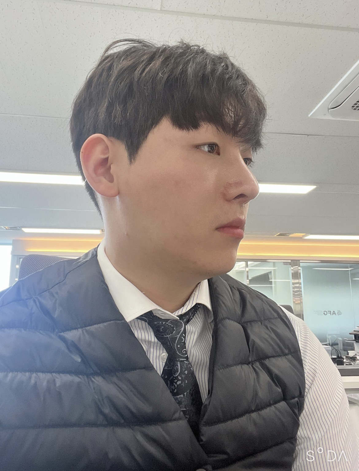 수술후기이미지