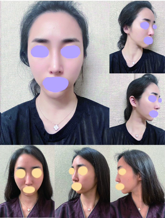 수술후기이미지