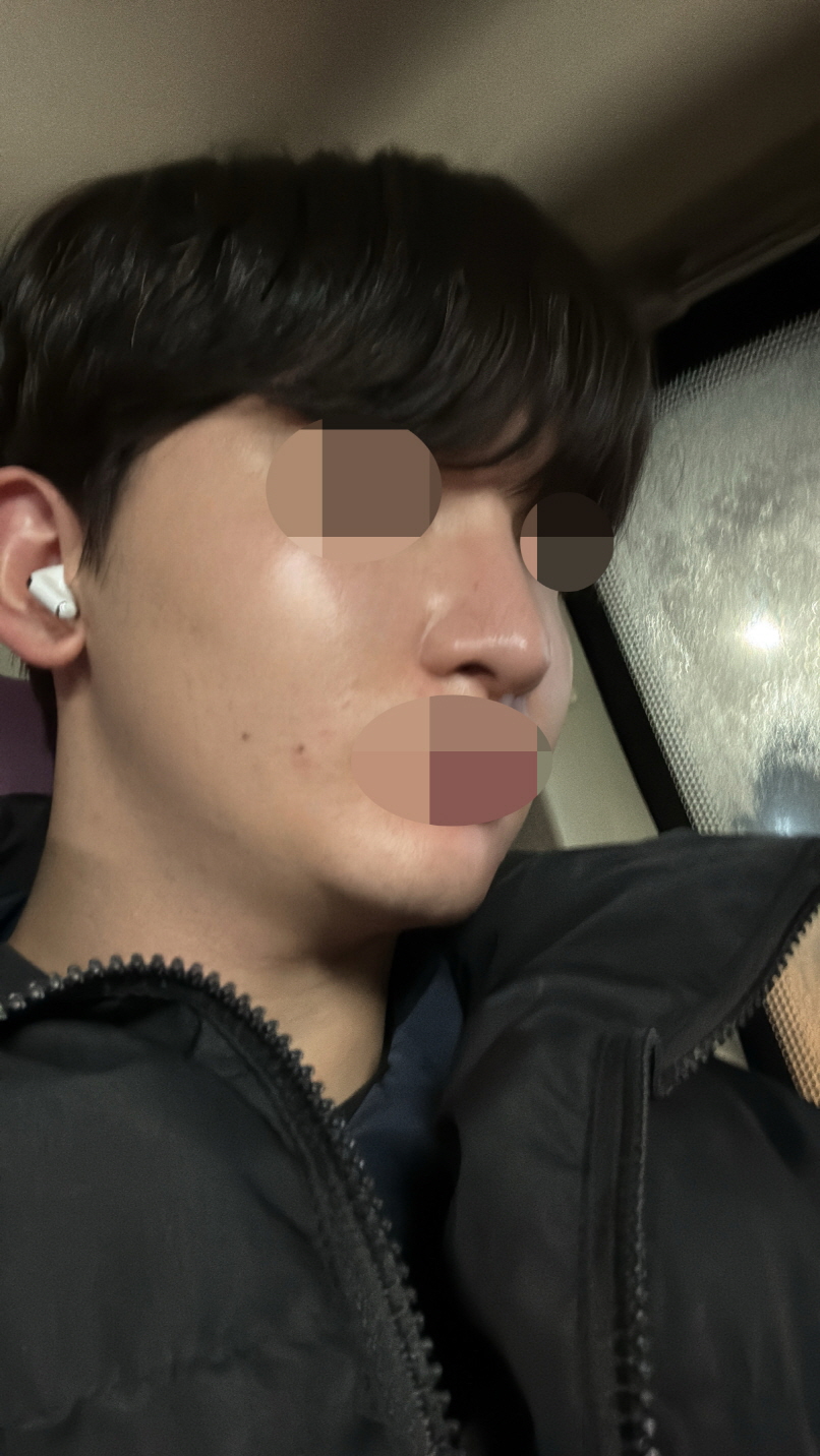 수술후기이미지