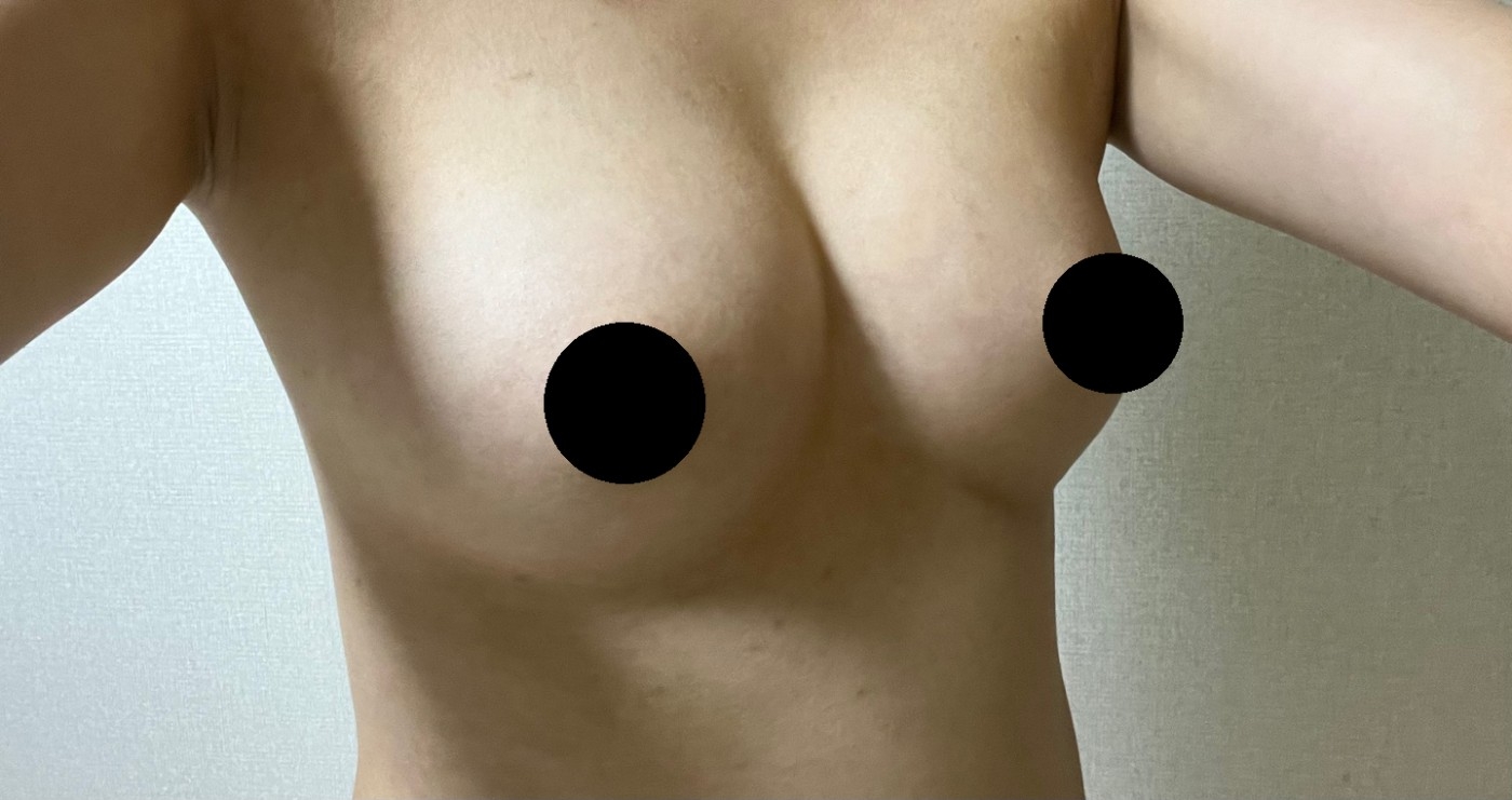 수술후기이미지