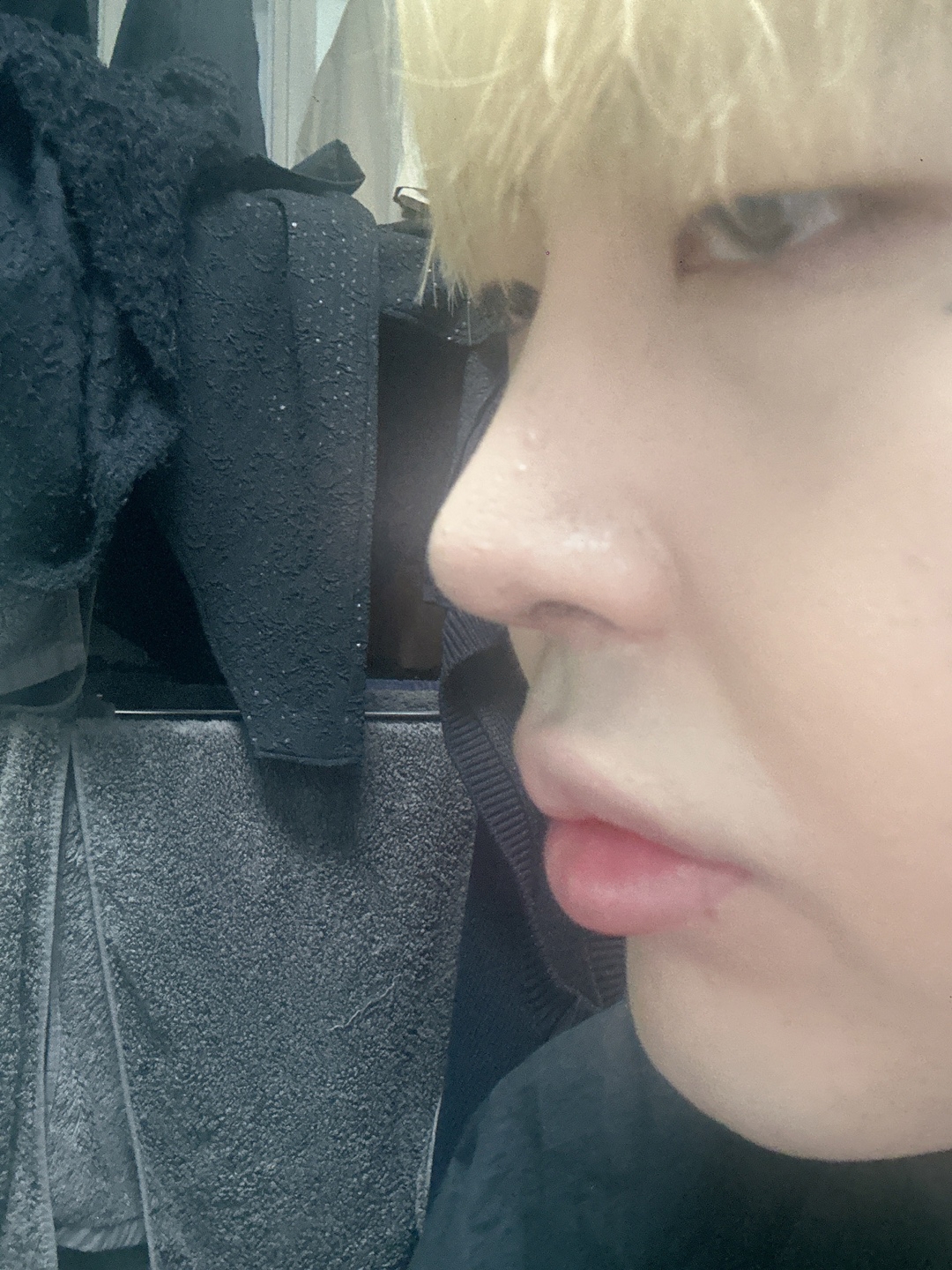 수술후기이미지