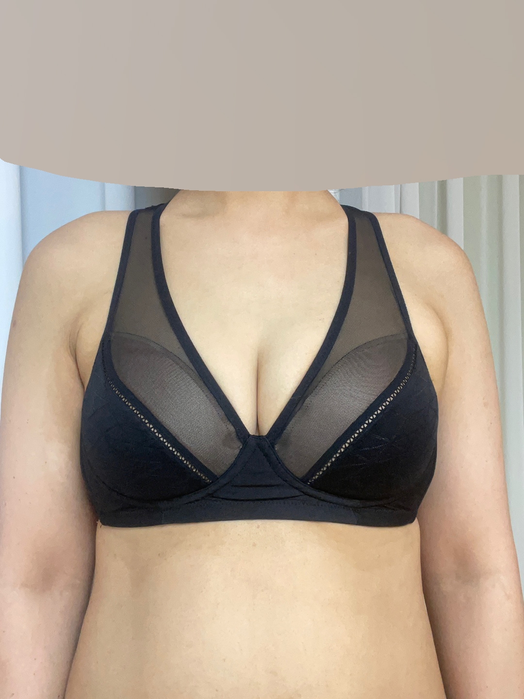 수술후기이미지