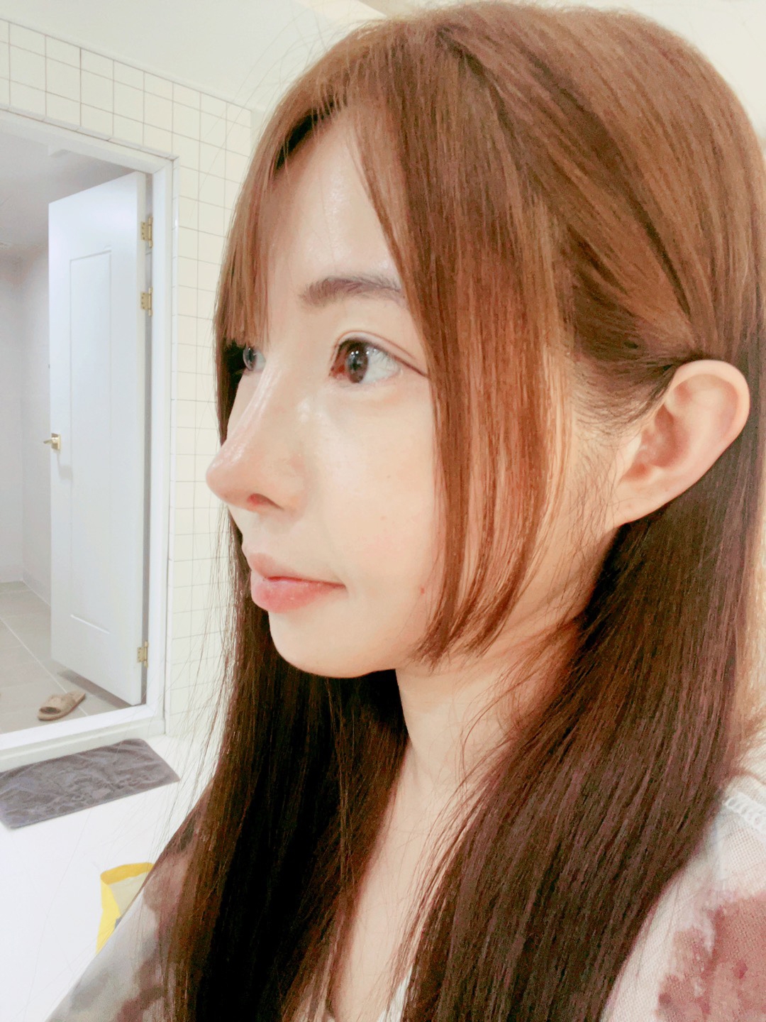 수술후기이미지