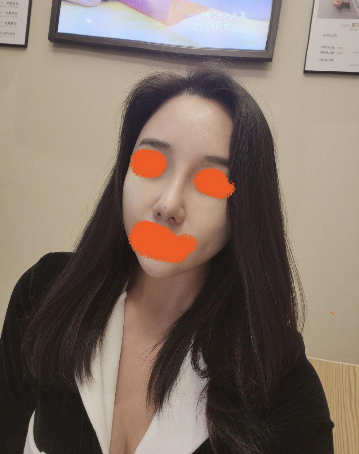 수술후기이미지