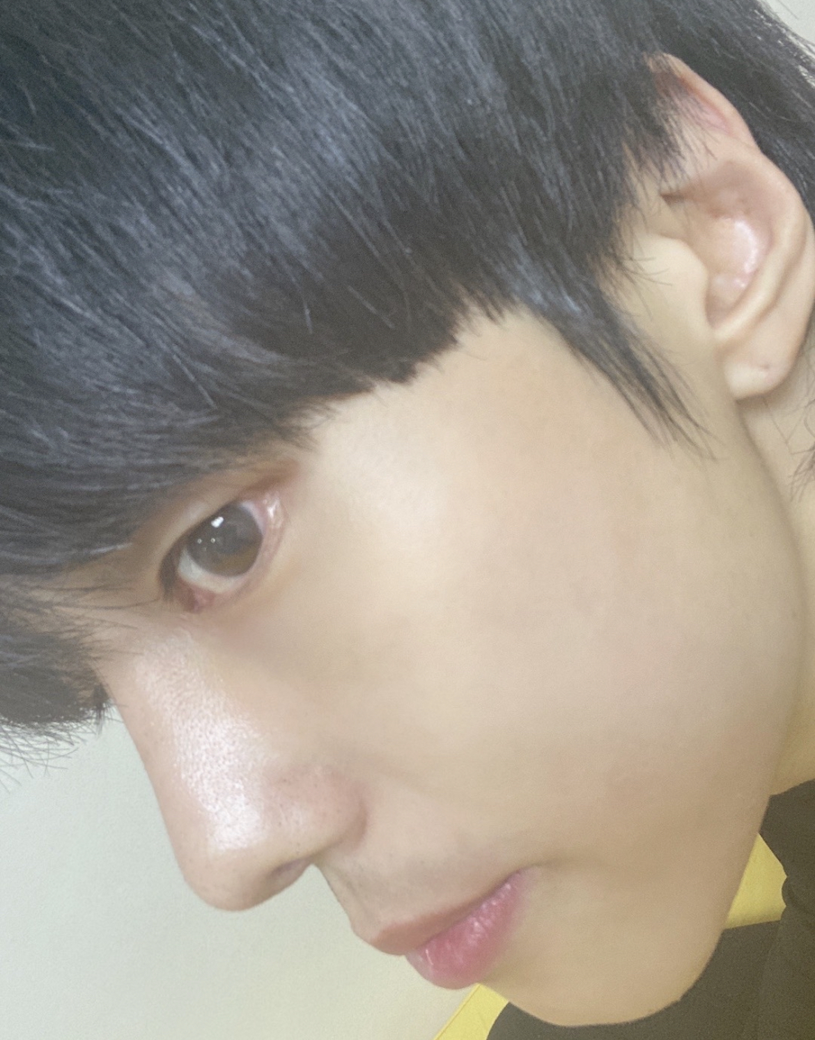 수술후기이미지