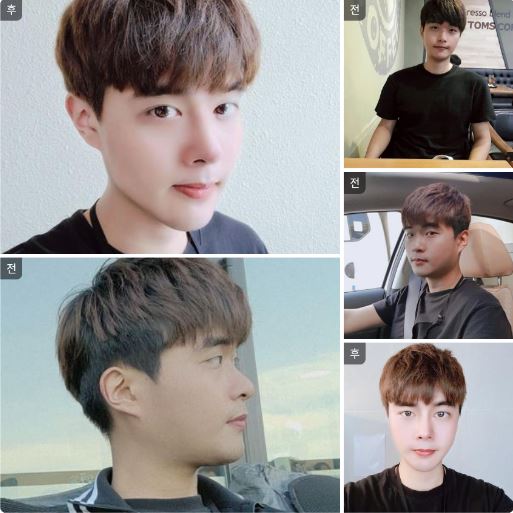 수술후기이미지