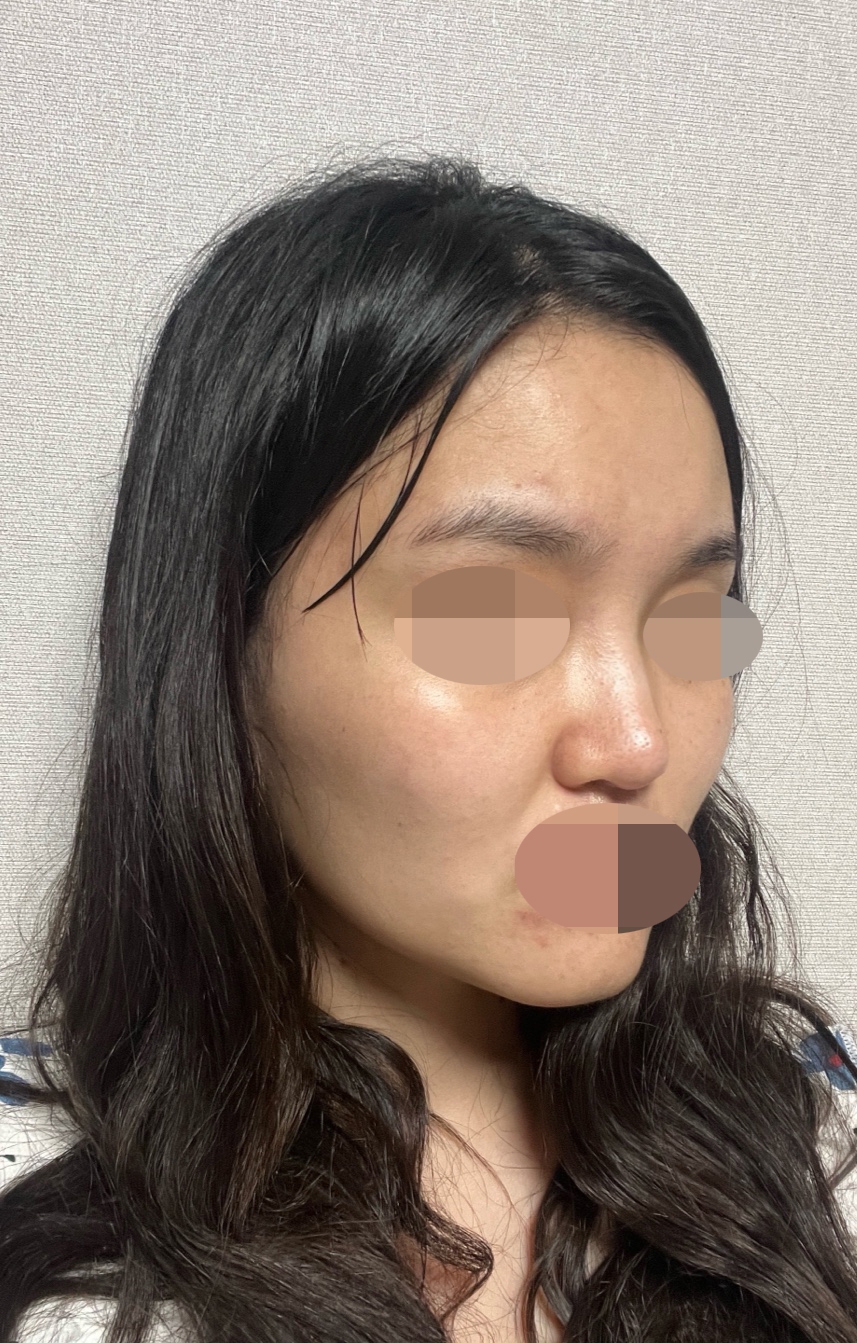 수술후기이미지