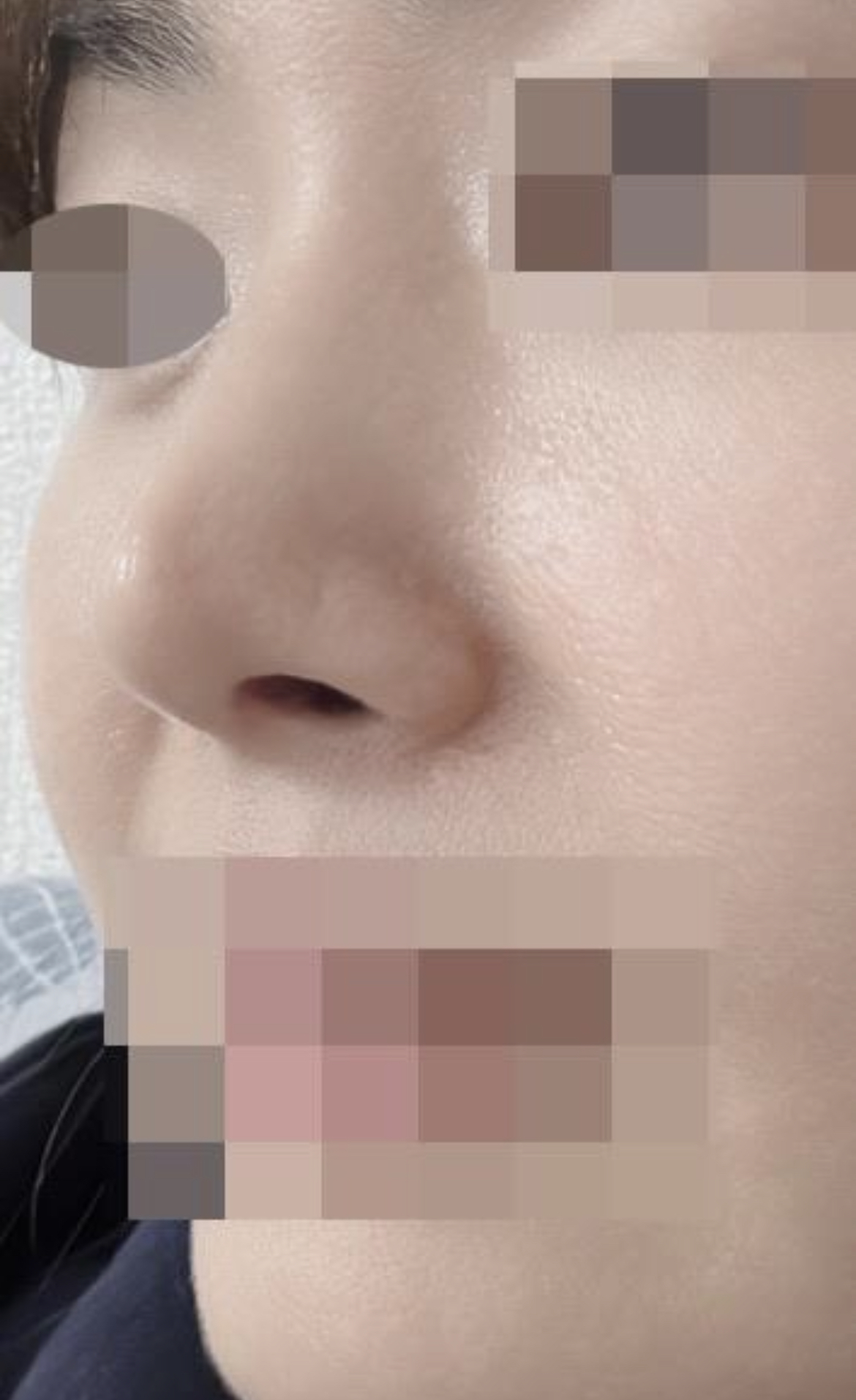 수술후기이미지