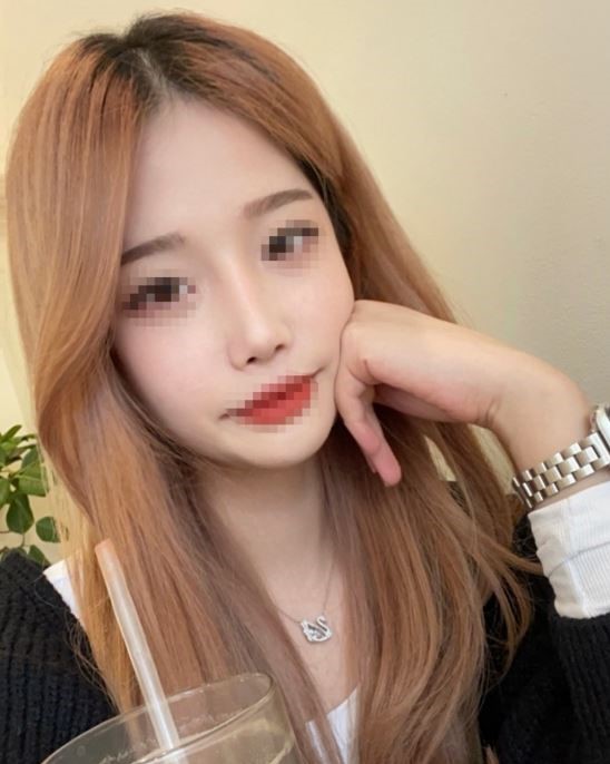 수술후기이미지