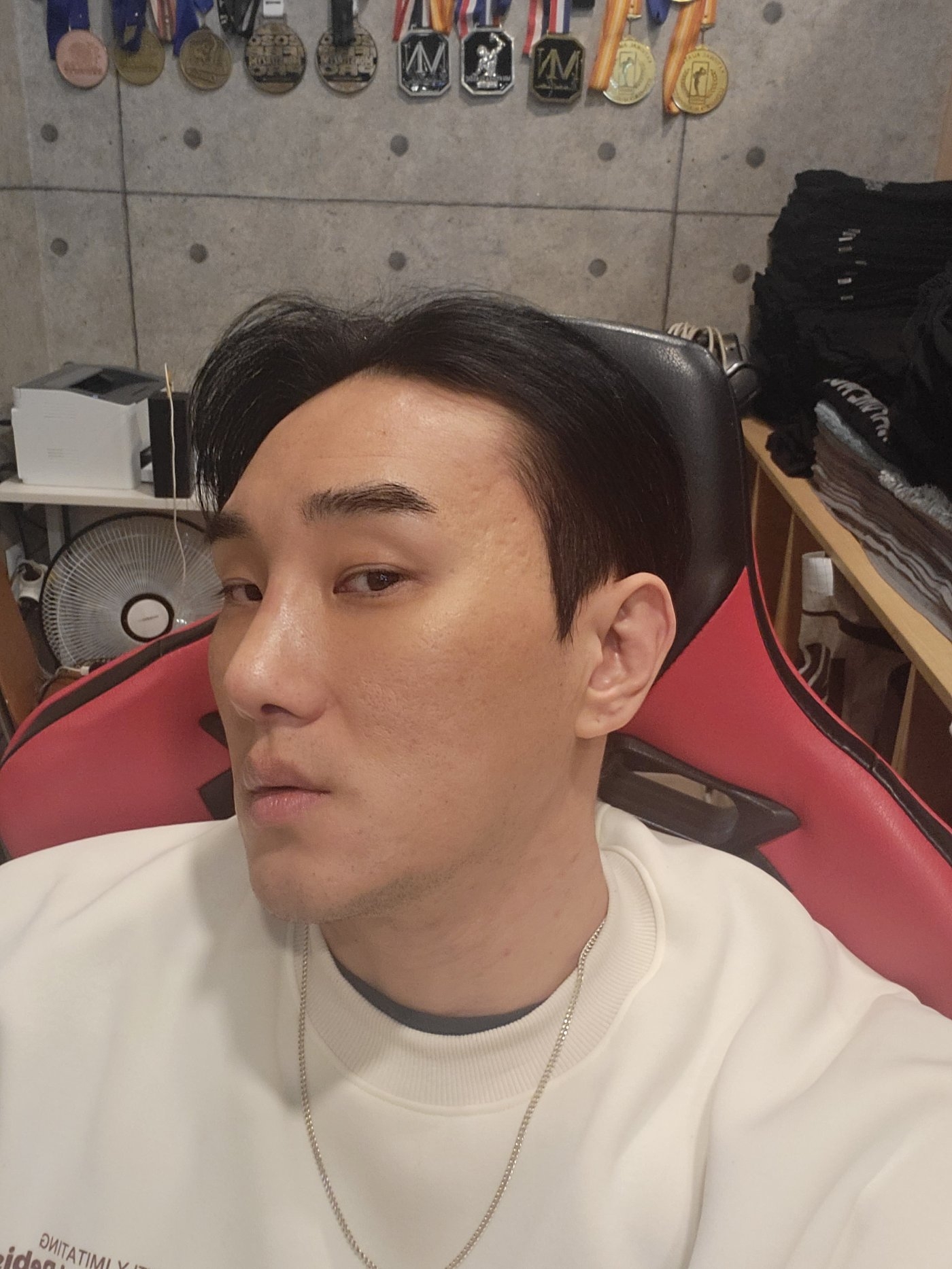 수술후기이미지