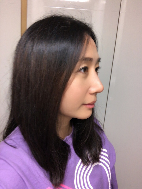 수술후기이미지