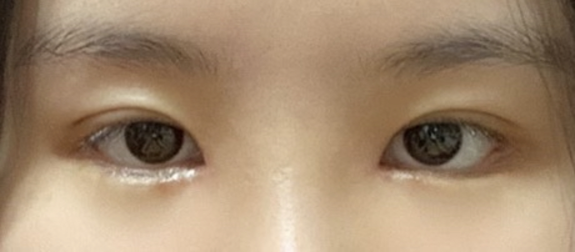 수술후기이미지