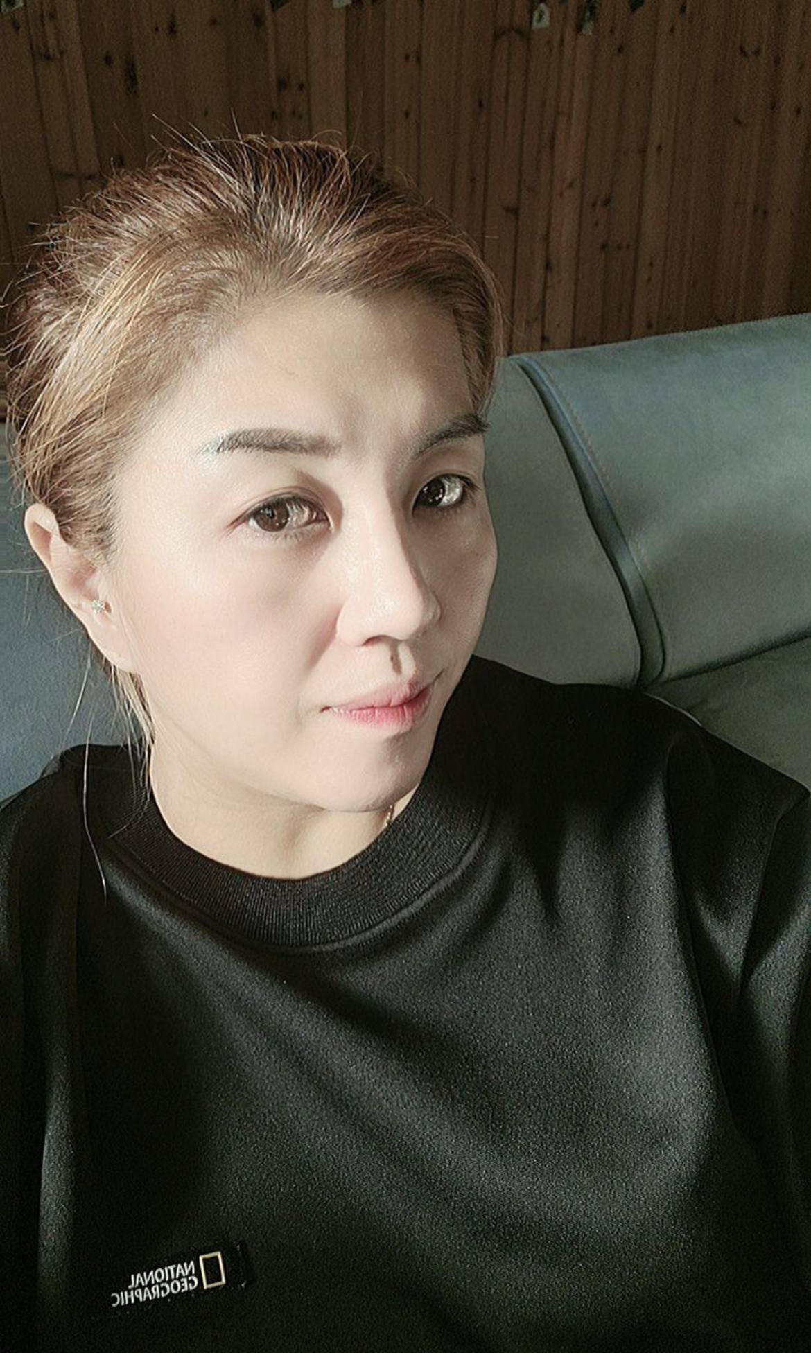 수술후기이미지