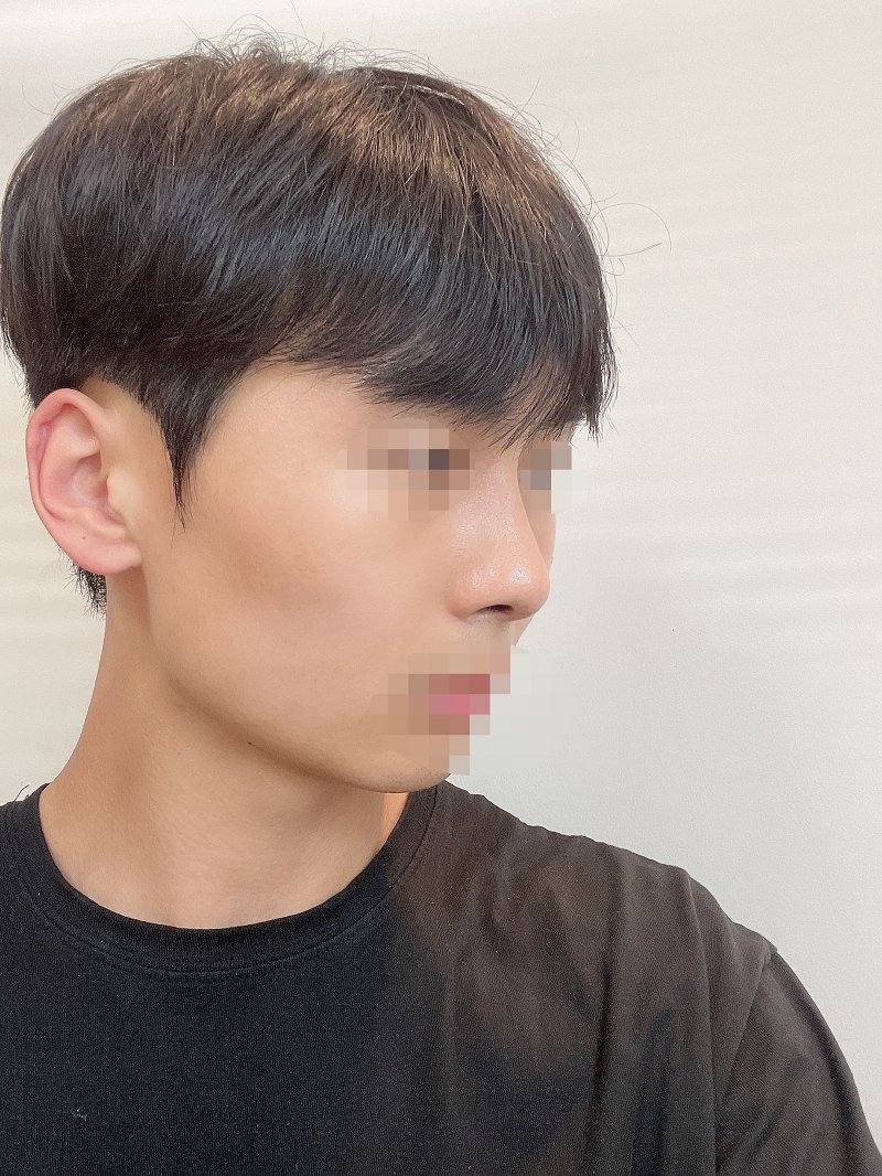 수술후기이미지