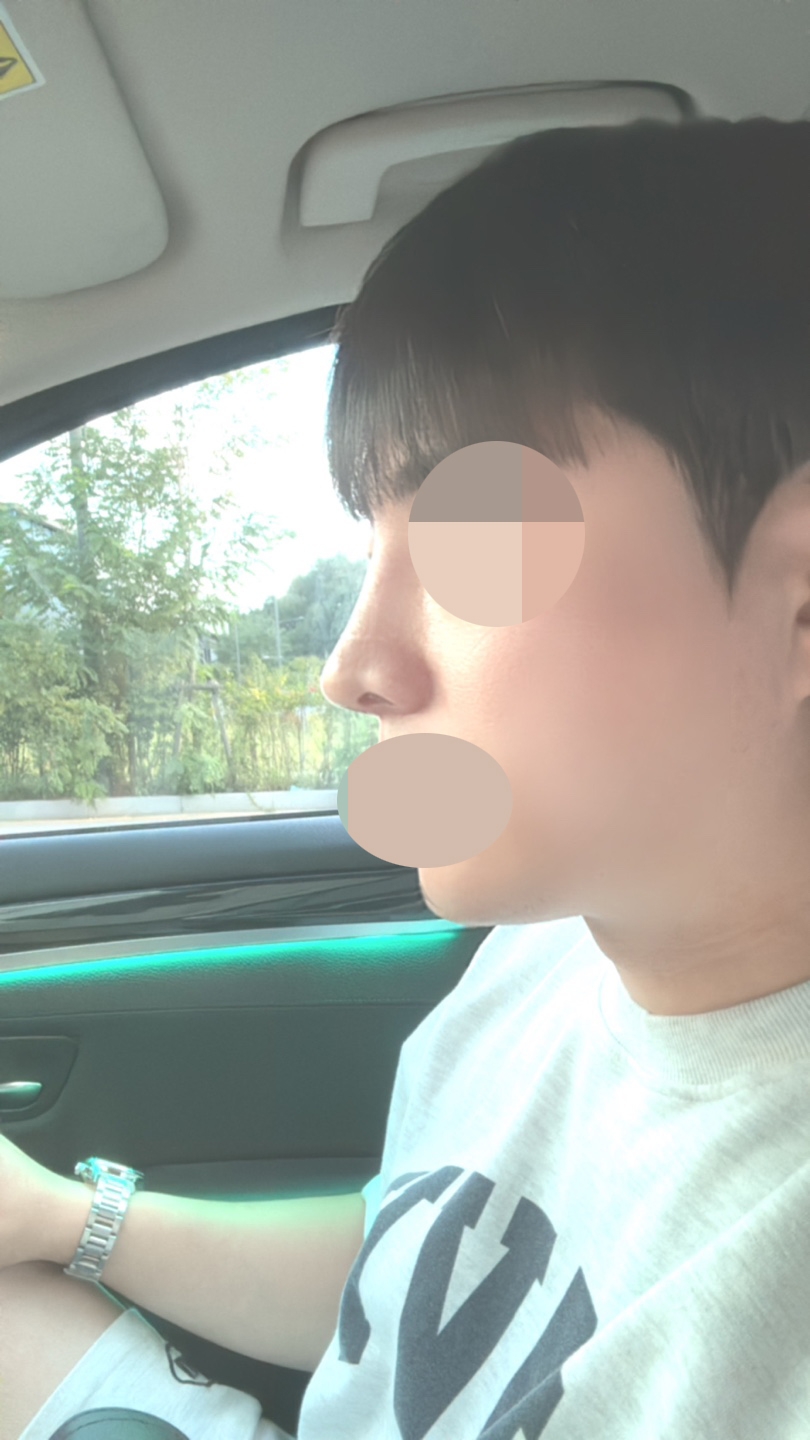 수술후기이미지