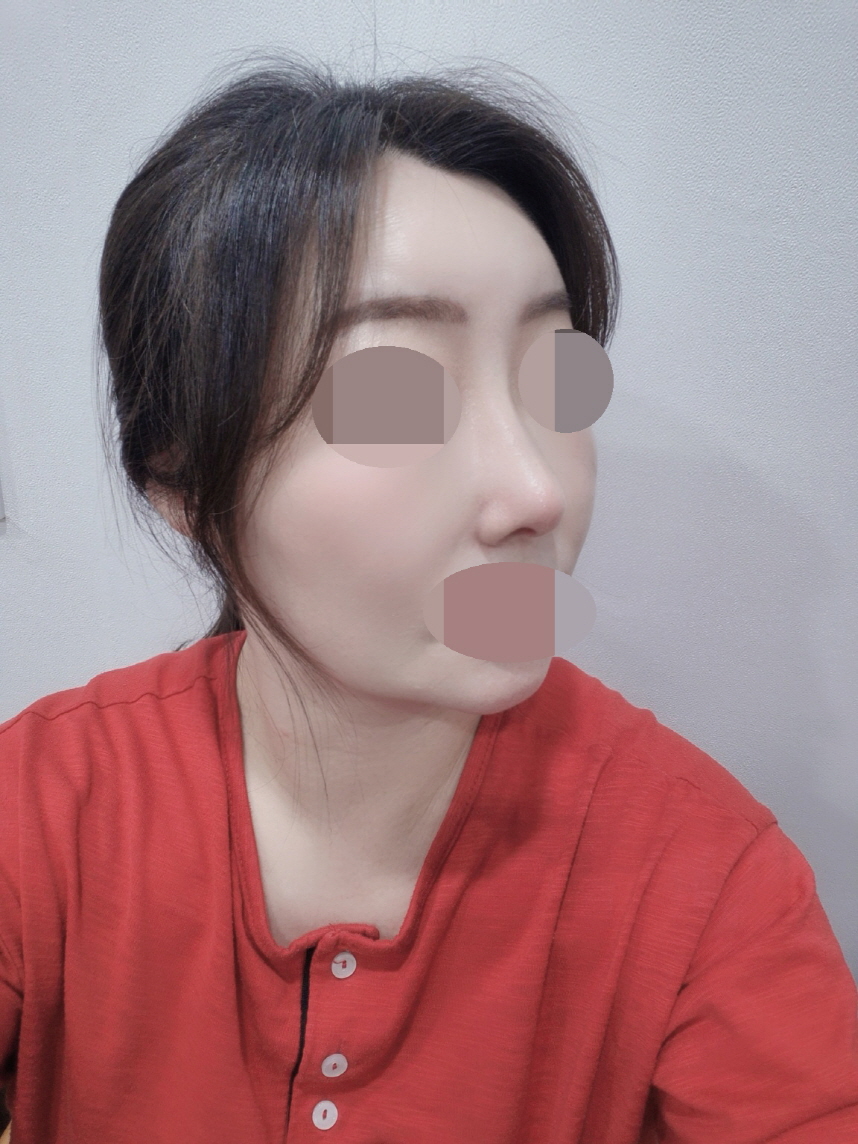 수술후기이미지