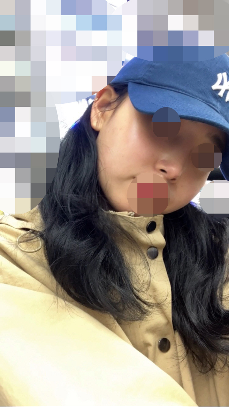 수술후기이미지