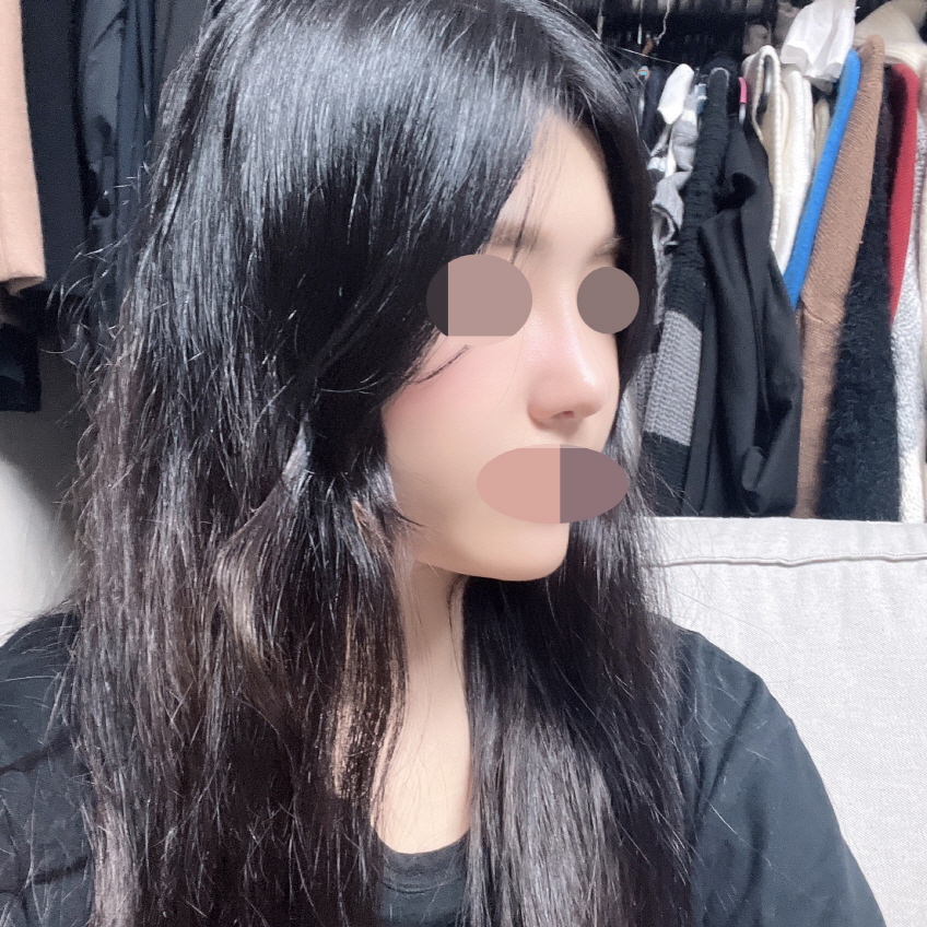 수술후기이미지