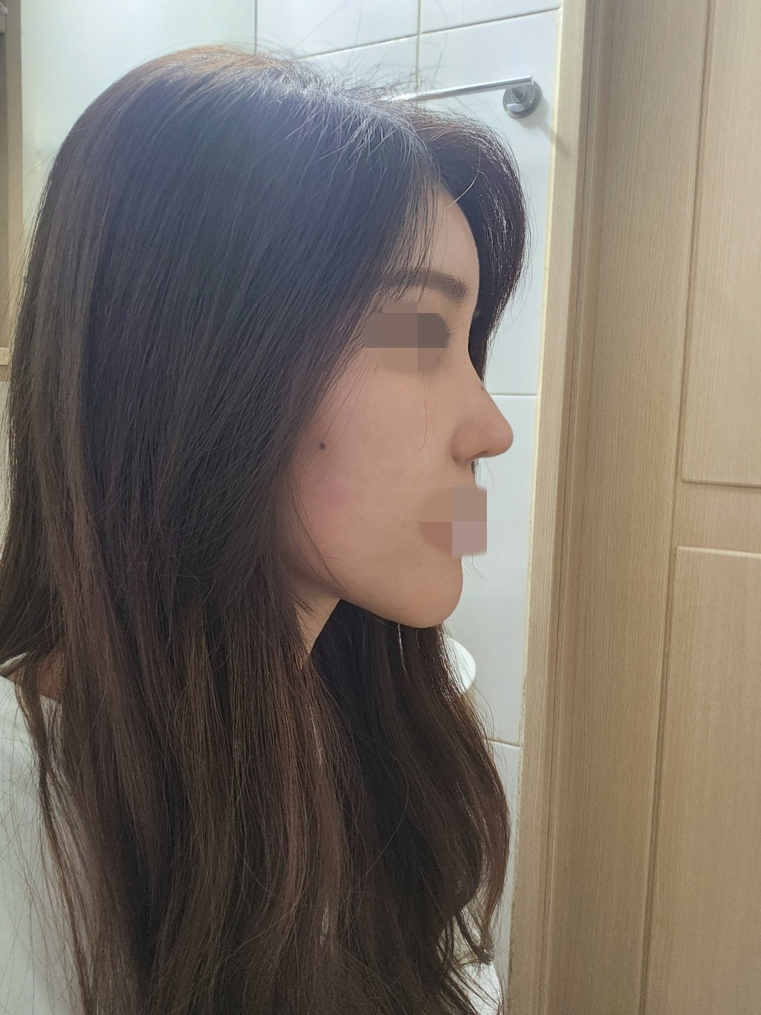 수술후기이미지