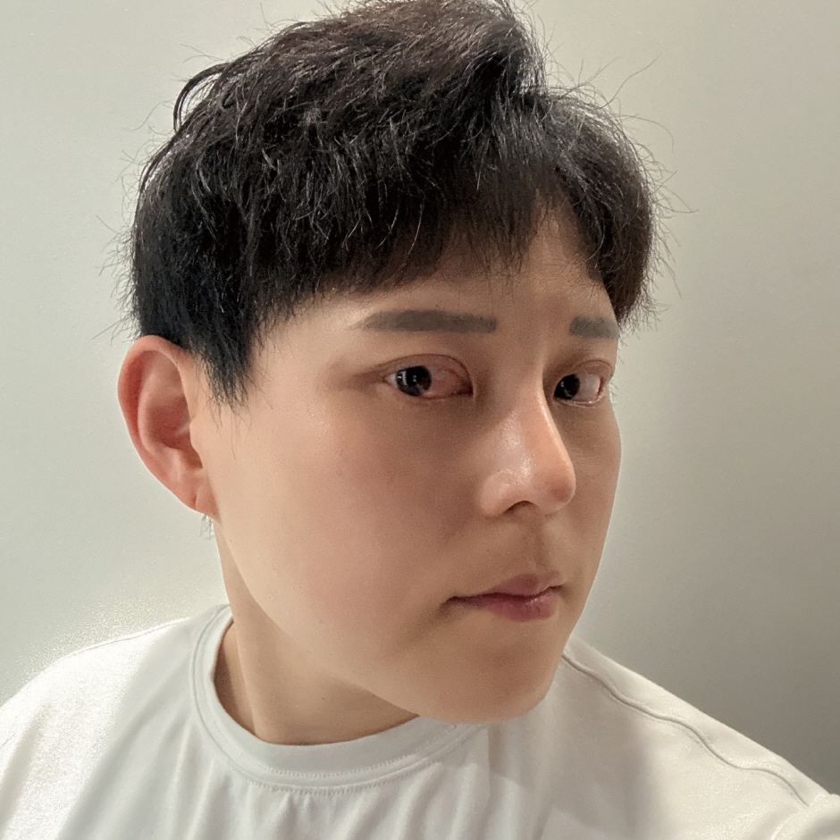 수술후기이미지