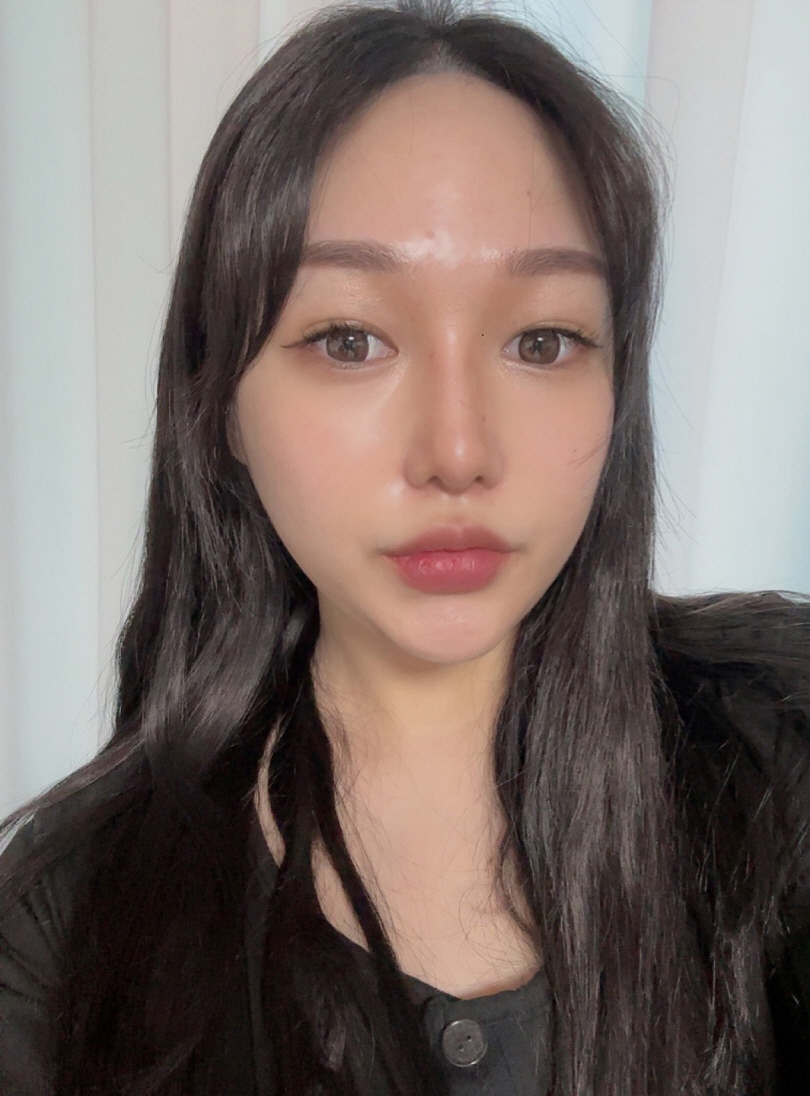 수술후기이미지