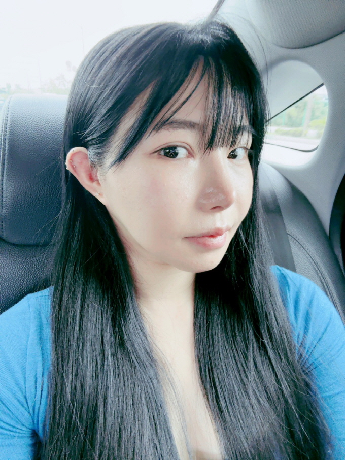 수술후기이미지