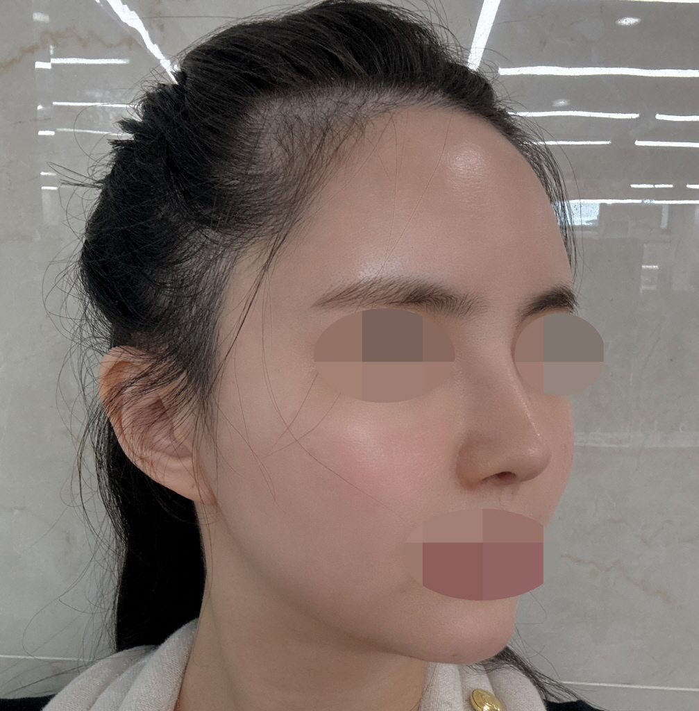 수술후기이미지