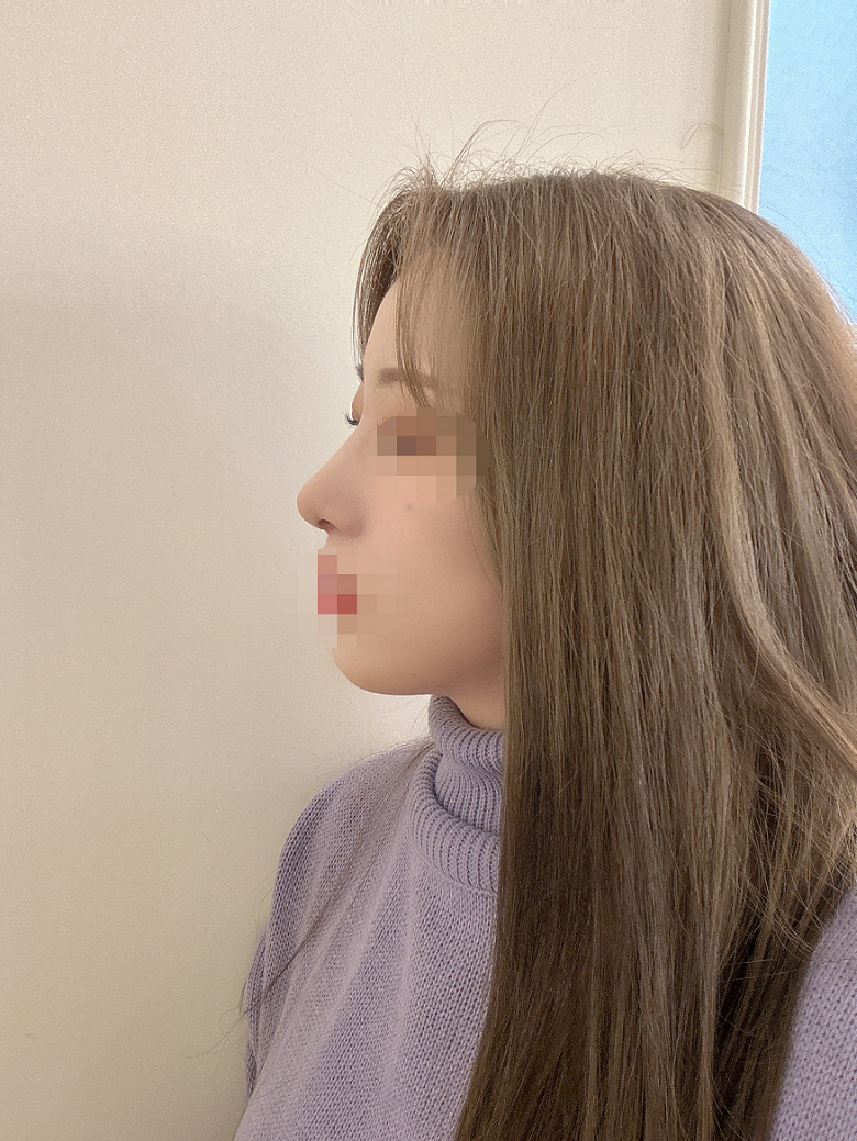 수술후기이미지