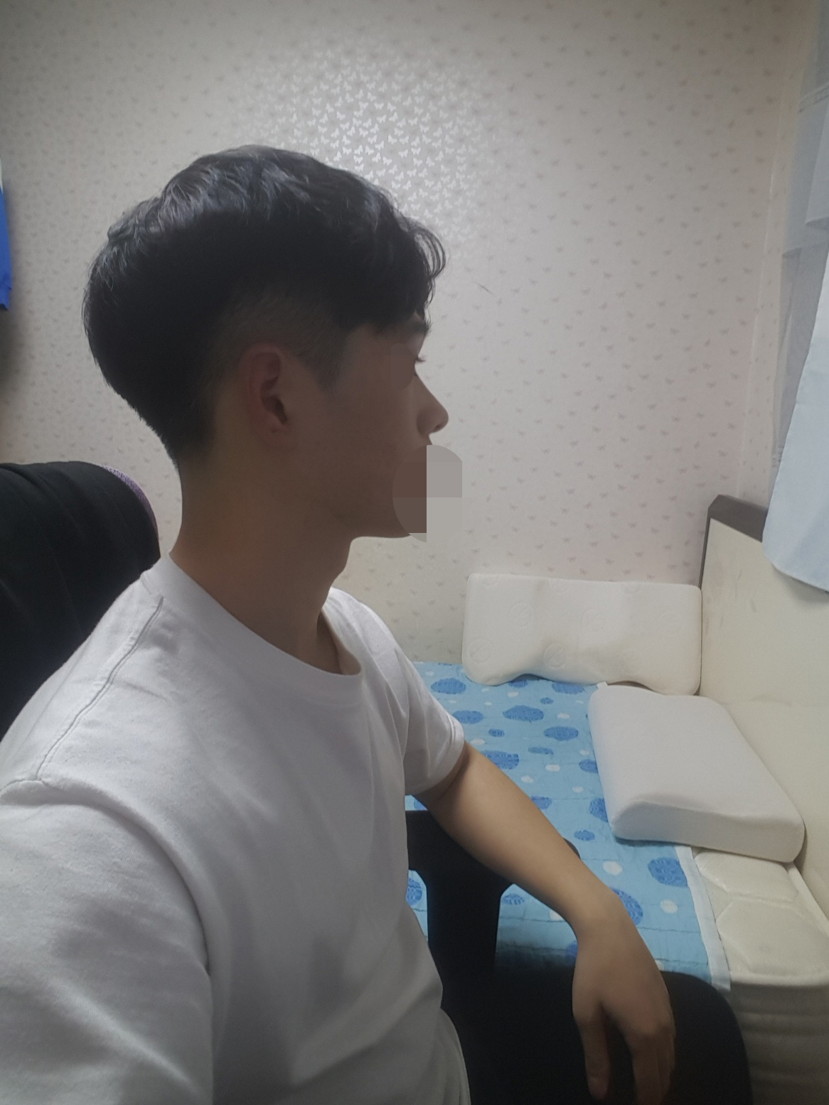 수술후기이미지