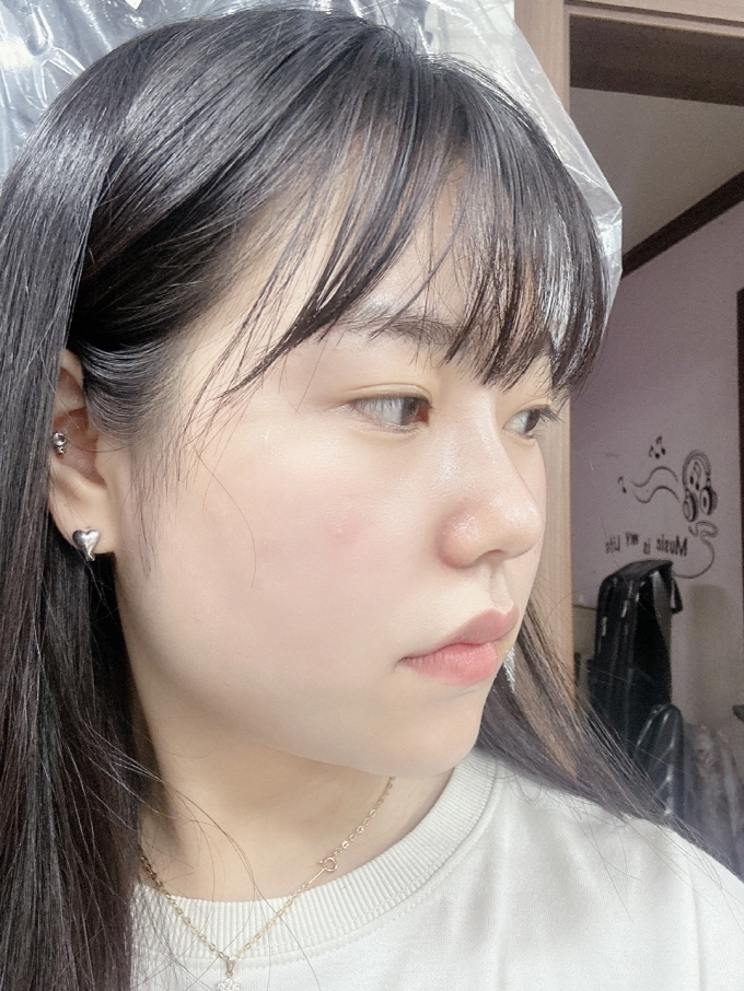 수술후기이미지