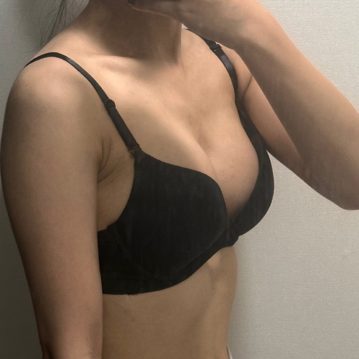 수술후기이미지